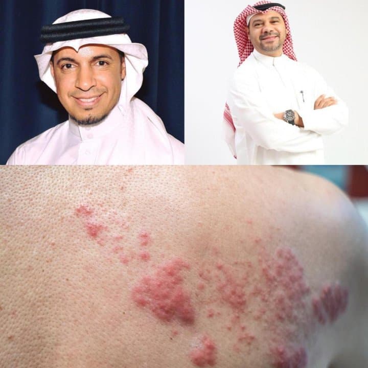 فعاليات توعوية تزامنًا مع الأسبوع العالمي للحزام الناري لرفع الوعي وتصحيح المفاهيم الخاطئة